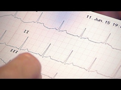 Free Online Course Ecg Assessment An Introduction For Healthcare Providers From Futurelearn Class Central