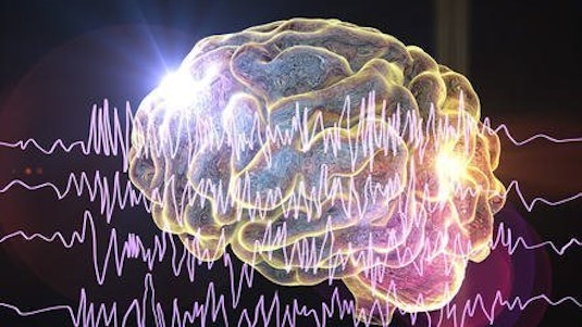 Free Online Course: Understanding Epilepsy and its Neuropsychology from  FutureLearn | Class Central